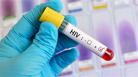 nova variante hiv